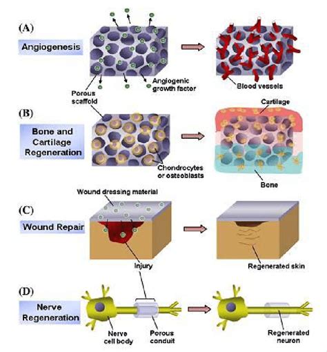 Ketoconazole-Embedded Biodegradable Polymeric Scaffold: Revolutionizing Tissue Regeneration in Orthopedic Applications?